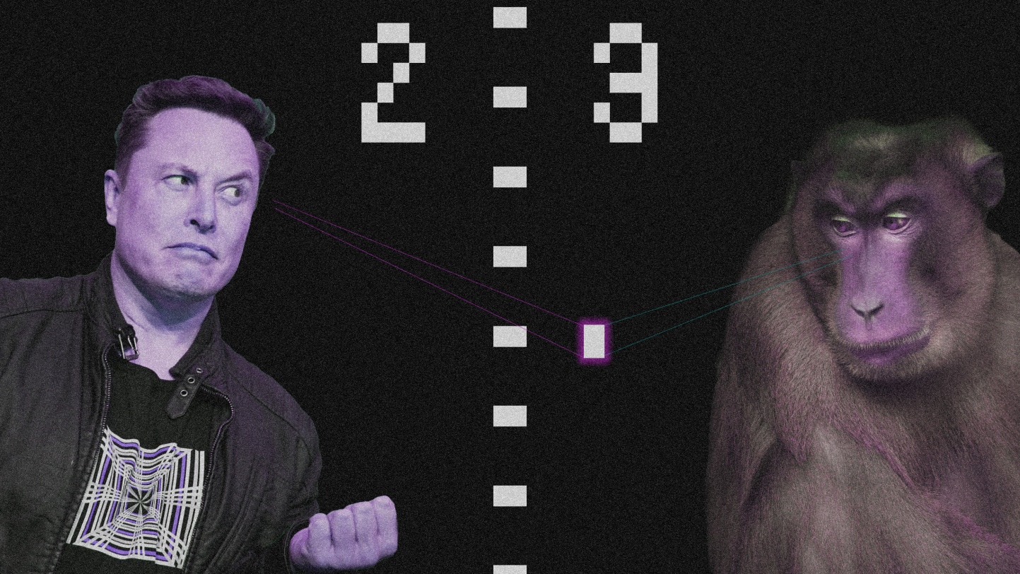Gamer with a brain implant challenges Neuralink's monkey to Pong